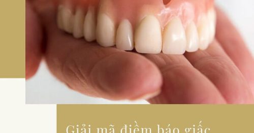 Mơ thấy răng giả là điềm báo gì? Đánh số nào để trúng lớn?